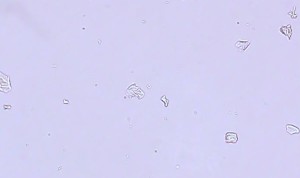 Epithelial cells in urine - Normal Range, Types